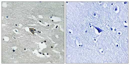 Immunohistochemistry (Formalin/PFA-fixed paraffin-embedded sections) - Anti-VEGF Receptor 1 (phospho Y1048) antibody (AB192802)