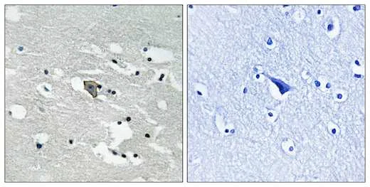 Immunohistochemistry (Formalin/PFA-fixed paraffin-embedded sections) - Anti-VEGF Receptor 1 (phospho Y1048) antibody (AB192802)
