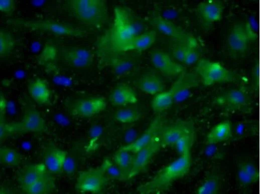 Immunocytochemistry/ Immunofluorescence - Anti-VEGF Receptor 2 antibody [#4 (20I6)] (AB39378)