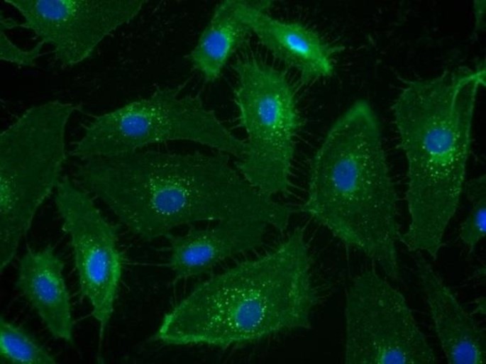 Immunocytochemistry/ Immunofluorescence - Anti-VEGF Receptor 2 antibody (AB11939)