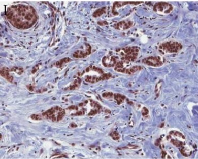 Immunohistochemistry (Formalin/PFA-fixed paraffin-embedded sections) - Anti-VEGF Receptor 2 antibody (AB2349), expandable thumbnail