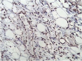 Immunohistochemistry (Formalin/PFA-fixed paraffin-embedded sections) - Anti-VEGF Receptor 2 antibody (AB2349), expandable thumbnail