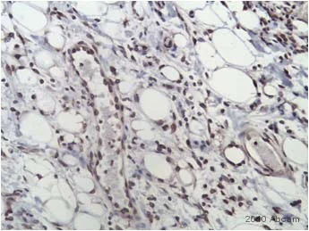 Immunohistochemistry (Formalin/PFA-fixed paraffin-embedded sections) - Anti-VEGF Receptor 2 antibody (AB2349)