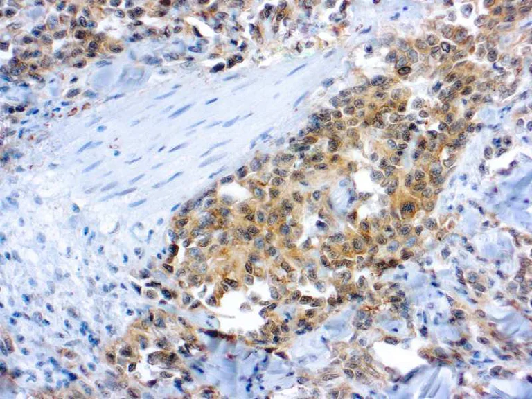 Immunohistochemistry (Formalin/PFA-fixed paraffin-embedded sections) - Anti-VEGF Receptor 2 antibody (AB2349)