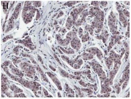 Immunohistochemistry (Formalin/PFA-fixed paraffin-embedded sections) - Anti-VEGF Receptor 2 antibody (AB2349)