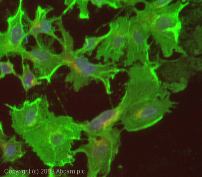 Immunocytochemistry/ Immunofluorescence - Anti-VEGF Receptor 2 antibody (AB39638)