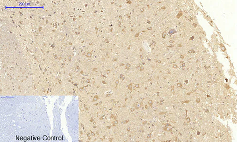 Immunohistochemistry (Formalin/PFA-fixed paraffin-embedded sections) - Anti-VEGF Receptor 2 antibody (AB39638)
