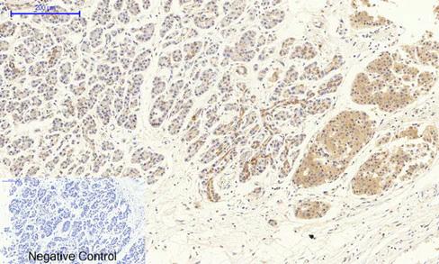 Immunohistochemistry (Formalin/PFA-fixed paraffin-embedded sections) - Anti-VEGF Receptor 2 antibody (AB39638)