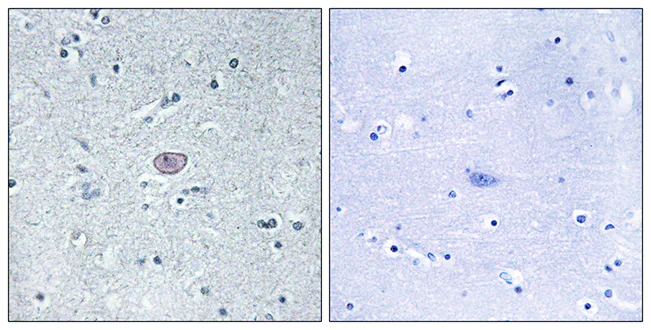 Immunohistochemistry (Formalin/PFA-fixed paraffin-embedded sections) - Anti-VEGF Receptor 2 antibody (AB39638)