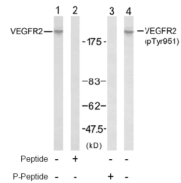 Western blot - Anti-VEGF Receptor 2 antibody (AB39638)