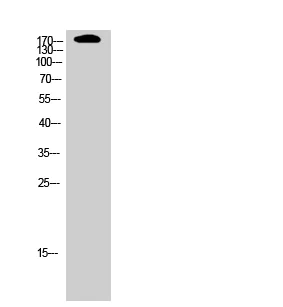 Western blot - Anti-VEGF Receptor 2 antibody (AB39638)
