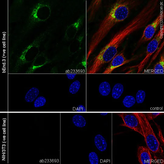 Immunocytochemistry/ Immunofluorescence - Anti-VEGF Receptor 2 antibody [EPR21884-236] (AB233693)