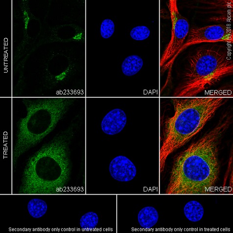 Immunocytochemistry/ Immunofluorescence - Anti-VEGF Receptor 2 antibody [EPR21884-236] (AB233693)