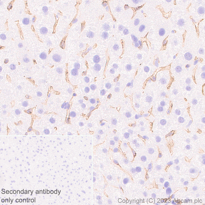 Immunohistochemistry (Formalin/PFA-fixed paraffin-embedded sections) - Anti-VEGF Receptor 2 antibody [EPR28328-80] (ab315238), expandable thumbnail