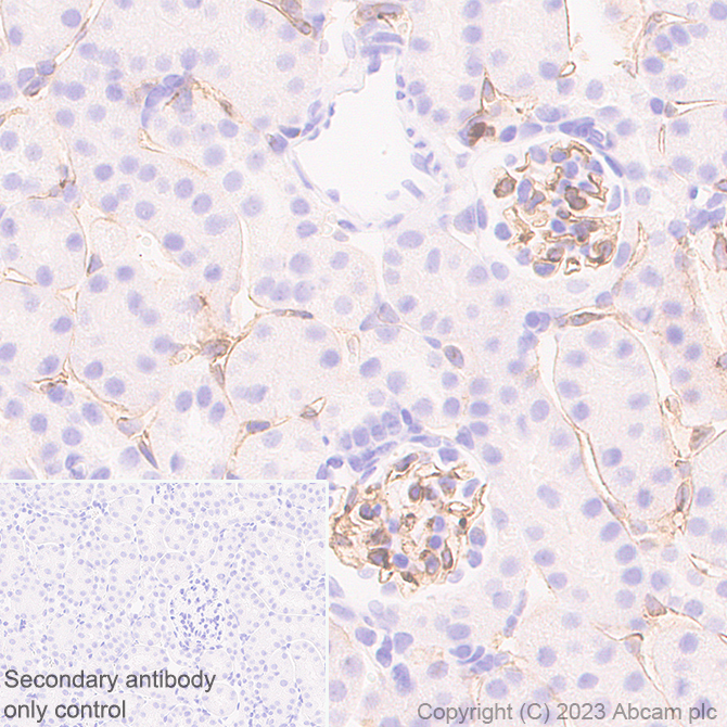 Immunohistochemistry (Formalin/PFA-fixed paraffin-embedded sections) - Anti-VEGF Receptor 2 antibody [EPR28328-80] (ab315238), expandable thumbnail