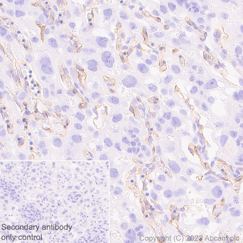 Immunohistochemistry (Formalin/PFA-fixed paraffin-embedded sections) - Anti-VEGF Receptor 2 antibody [EPR28328-80] (AB315238), expandable thumbnail