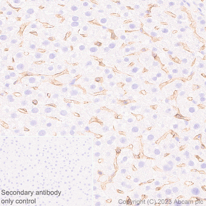 Immunohistochemistry (Formalin/PFA-fixed paraffin-embedded sections) - Anti-VEGF Receptor 2 antibody [EPR28328-80] (AB315238), expandable thumbnail