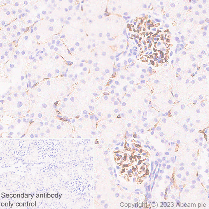 Immunohistochemistry (Formalin/PFA-fixed paraffin-embedded sections) - Anti-VEGF Receptor 2 antibody [EPR28328-80] (AB315238), expandable thumbnail