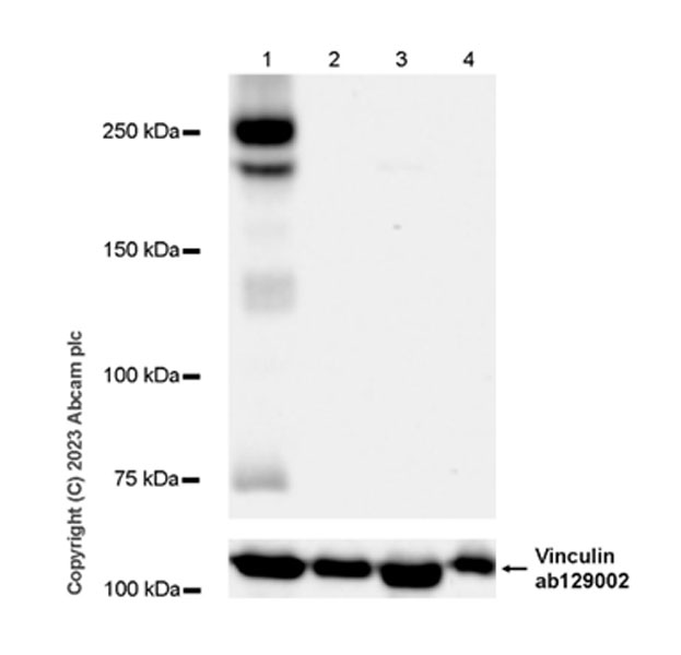 Western blot - Anti-VEGF Receptor 2 antibody [EPR28328-80] (ab315238), expandable thumbnail