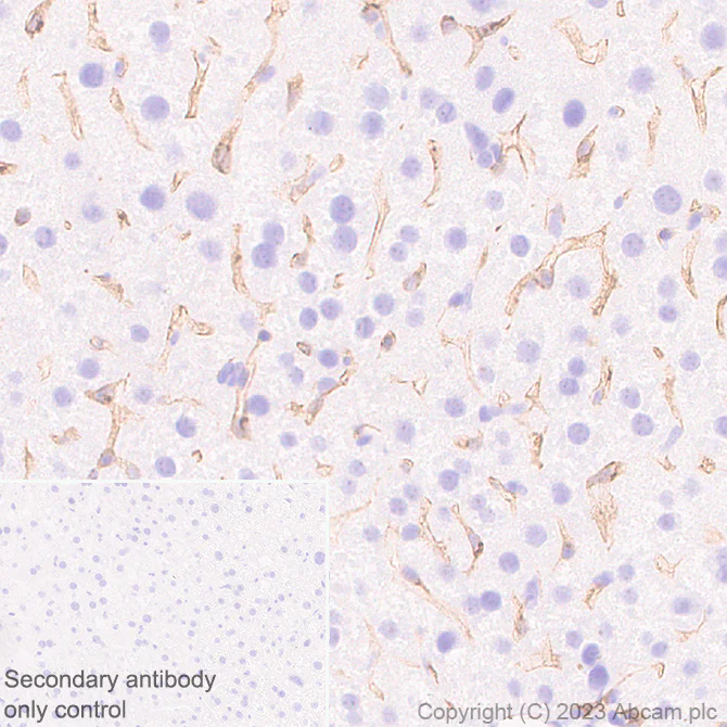 Immunohistochemistry (Formalin/PFA-fixed paraffin-embedded sections) - Anti-VEGF Receptor 2 antibody [EPR28328-80] - BSA and Azide free (AB315239)