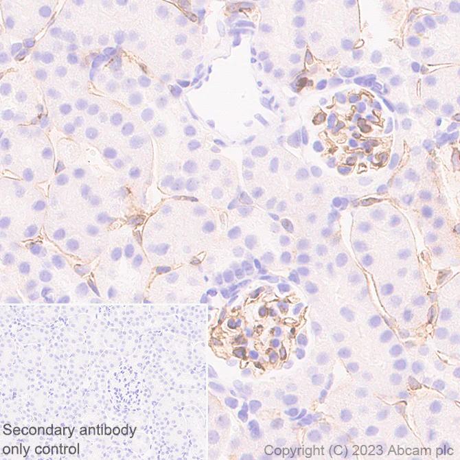 Immunohistochemistry (Formalin/PFA-fixed paraffin-embedded sections) - Anti-VEGF Receptor 2 antibody [EPR28328-80] - BSA and Azide free (AB315239)