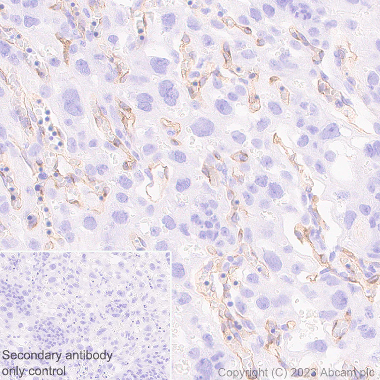 Immunohistochemistry (Formalin/PFA-fixed paraffin-embedded sections) - Anti-VEGF Receptor 2 antibody [EPR28328-80] - BSA and Azide free (AB315239)