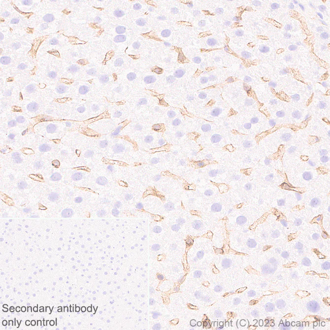 Immunohistochemistry (Formalin/PFA-fixed paraffin-embedded sections) - Anti-VEGF Receptor 2 antibody [EPR28328-80] - BSA and Azide free (AB315239)