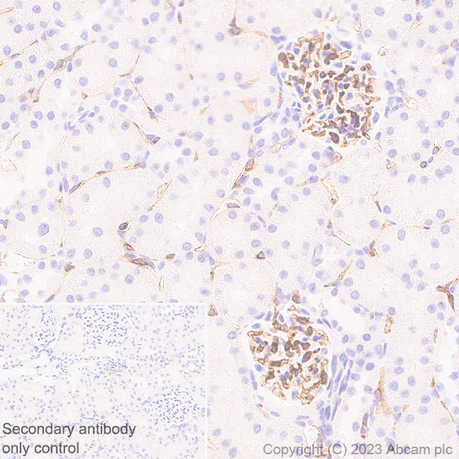 Immunohistochemistry (Formalin/PFA-fixed paraffin-embedded sections) - Anti-VEGF Receptor 2 antibody [EPR28328-80] - BSA and Azide free (AB315239)