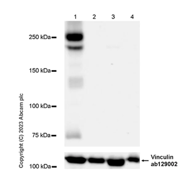 Western blot - Anti-VEGF Receptor 2 antibody [EPR28328-80] - BSA and Azide free (AB315239)
