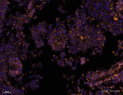 Immunohistochemistry (Formalin/PFA-fixed paraffin-embedded sections) - Anti-VEGF Receptor 2 antibody [SP123] (AB115805)