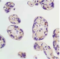 Immunohistochemistry (Formalin/PFA-fixed paraffin-embedded sections) - Anti-VEGF Receptor 2 antibody [SP123] - BSA and Azide free (AB243912)
