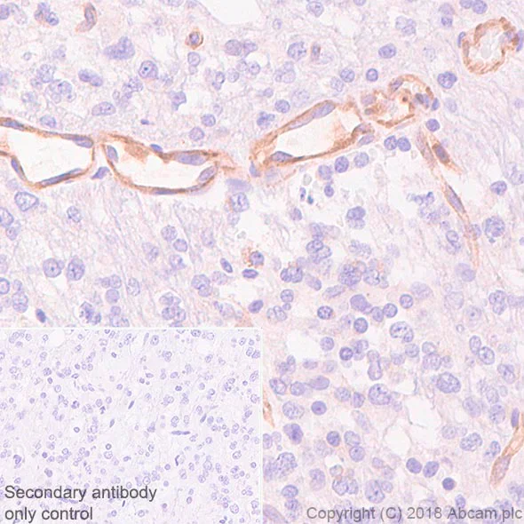 Immunohistochemistry (Formalin/PFA-fixed paraffin-embedded sections) - Anti-VEGF Receptor 2 antibody [SP123] - BSA and Azide free (AB243912)