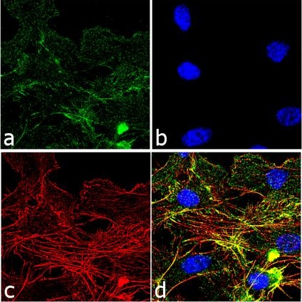 Immunocytochemistry - Anti-VEGF Receptor 2 (phospho Y1054 + Y1059) antibody (AB5473), expandable thumbnail