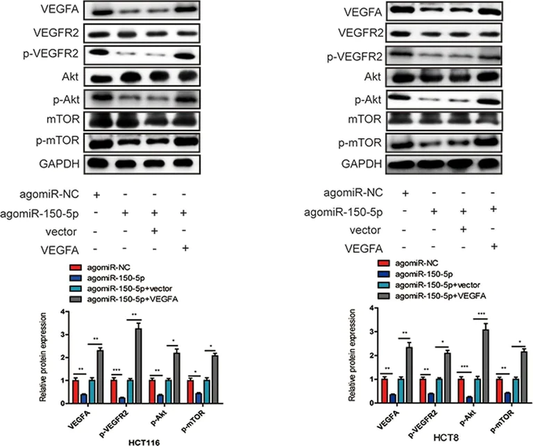 Western blot - Anti-VEGF Receptor 2 (phospho Y1175) antibody (AB194806)