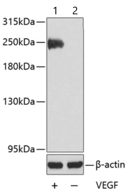Western blot - Anti-VEGF Receptor 2 (phospho Y1175) antibody (AB194806)