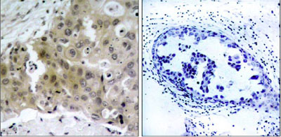 Immunohistochemistry (Formalin/PFA-fixed paraffin-embedded sections) - Anti-VEGF Receptor 2 (phospho Y1175) antibody (AB38464), expandable thumbnail