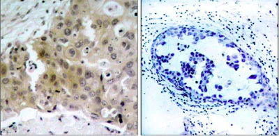 Immunohistochemistry (Formalin/PFA-fixed paraffin-embedded sections) - Anti-VEGF Receptor 2 (phospho Y1175) antibody (AB38464)