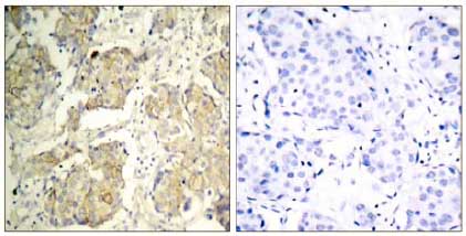 Immunohistochemistry (Formalin/PFA-fixed paraffin-embedded sections) - Anti-VEGF Receptor 2 (phospho Y1214) antibody (AB131241)