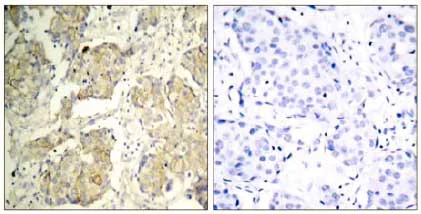 Immunohistochemistry (Formalin/PFA-fixed paraffin-embedded sections) - Anti-VEGF Receptor 2 (phospho Y1214) antibody (AB131241)
