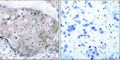 Immunohistochemistry (Formalin/PFA-fixed paraffin-embedded sections) - Anti-VEGF Receptor 2 (phospho Y951) antibody (AB38473)