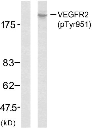Anti-VEGF Receptor 2 (phospho Y951) antibody (ab38473) | Abcam