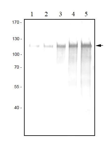 Western blot - Anti-VEGF Receptor 3 antibody [9D9] (AB273147)