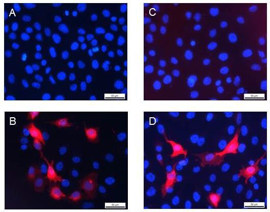 Immunocytochemistry/ Immunofluorescence - Anti-VEGF Receptor 3 antibody (AB10284), expandable thumbnail