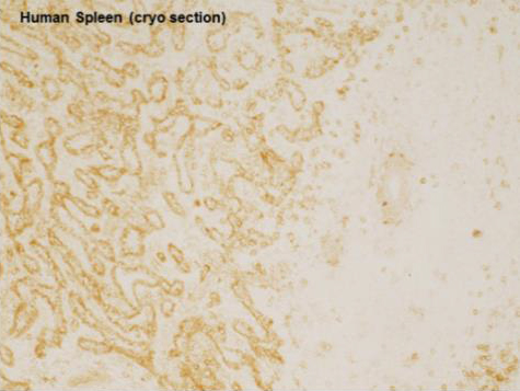 Immunohistochemistry (Frozen sections) - Anti-VEGF Receptor 3 antibody (AB10284), expandable thumbnail