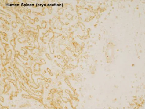 Immunohistochemistry (Frozen sections) - Anti-VEGF Receptor 3 antibody (AB10284)