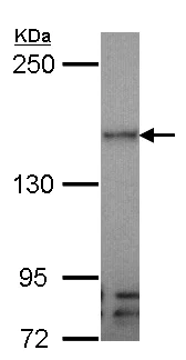 Western blot - Anti-VEGF Receptor 3 antibody (AB154079)