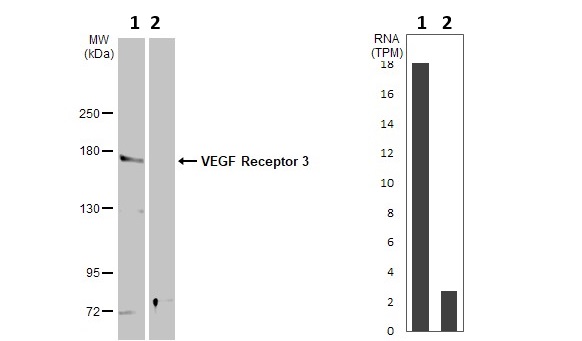 Western blot - Anti-VEGF Receptor 3 antibody (AB154079)