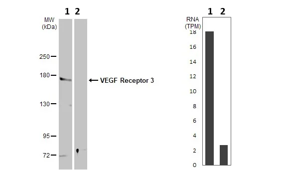 Western blot - Anti-VEGF Receptor 3 antibody (AB154079)