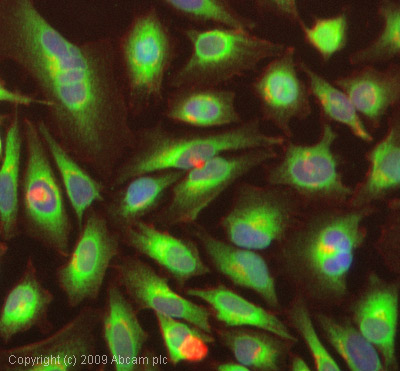 Immunocytochemistry/ Immunofluorescence - Anti-VEGF Receptor 3 antibody (AB27278), expandable thumbnail
