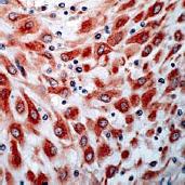 Immunohistochemistry (Formalin/PFA-fixed paraffin-embedded sections) - Anti-VEGF Receptor 3 antibody (AB27278), expandable thumbnail